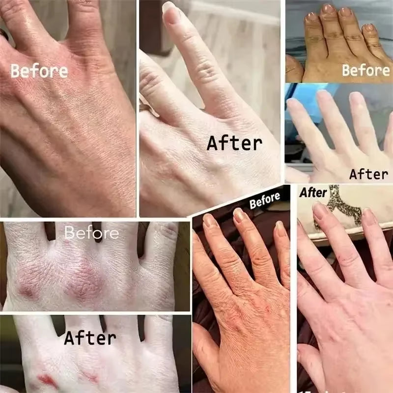 SADOER Kojic Acid Hand Cream Moisturizinganti-Chappingnourishingbrighteninghydrating Hand Creams Beauty Hands Skin Care Products