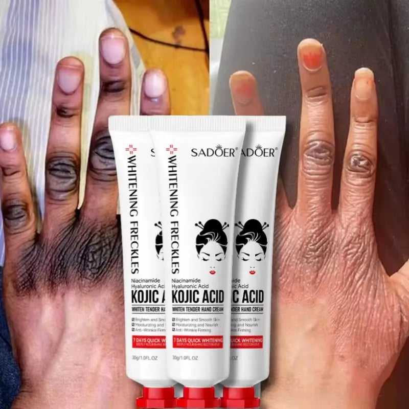 SADOER Kojic Acid Hand Cream Moisturizinganti-Chappingnourishingbrighteninghydrating Hand Creams Beauty Hands Skin Care Products